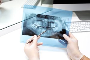 How often do you need dental X-rays?